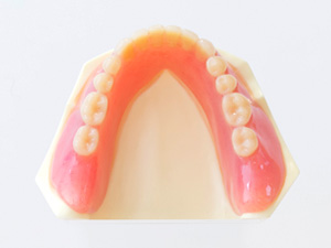 スマイルデンチャー