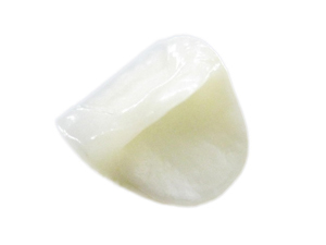 審美歯科メニュー