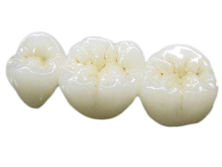 審美歯科メニュー