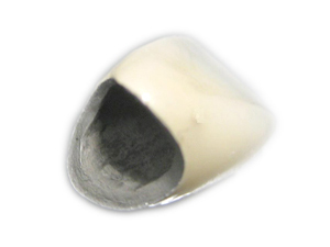 審美歯科メニュー