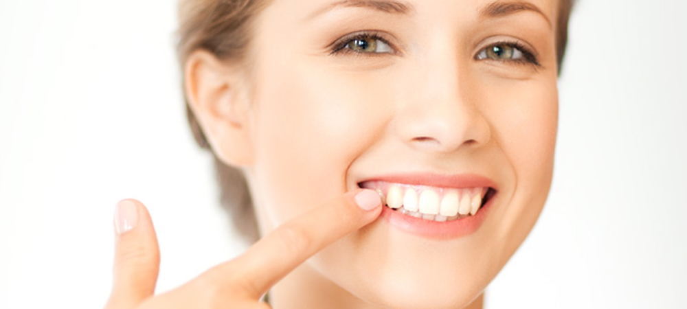 ホワイトニング