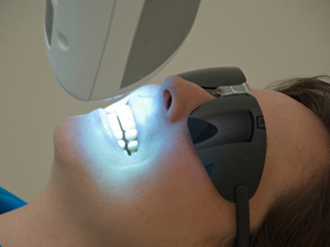 ホワイトニング